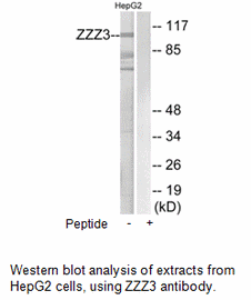 Product image for ZZZ3 Antibody