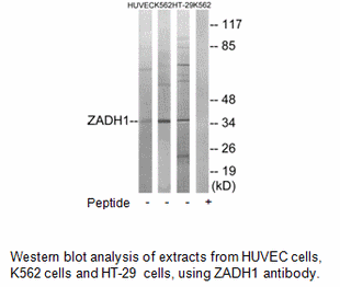 Product image for ZADH1 Antibody