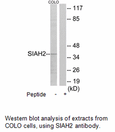 Product image for SIAH2 Antibody