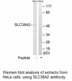 Product image for SLC38A2 Antibody