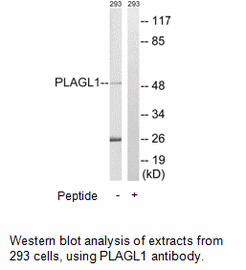 Product image for PLAGL1 Antibody