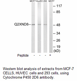 Product image for Cytochrome P450 2D6 Antibody