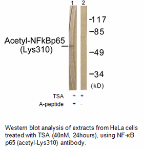 Product image for NF-&kappa;B p65 (Acetyl-Lys310) Antibody