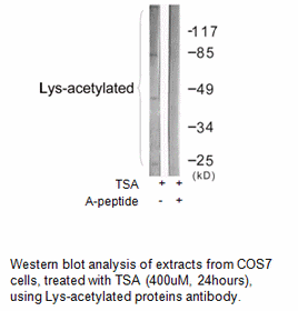 Product image for Lys-acetylated proteins Antibody