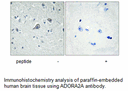 Product image for ADORA2A Antibody