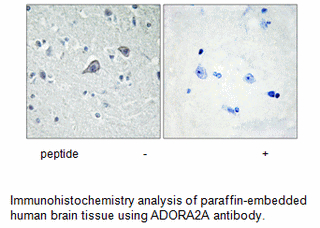 Product image for ADORA2A Antibody