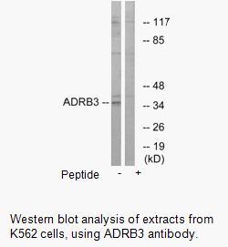 Product image for ADRB3 Antibody
