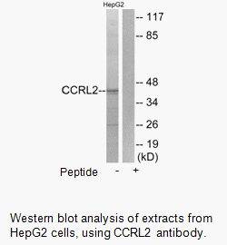 Product image for CCRL2 Antibody
