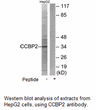 Product image for CCBP2 Antibody