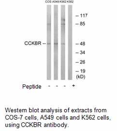 Product image for CCKBR Antibody