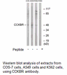 Product image for CCKBR Antibody