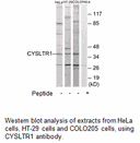 Product image for CYSLTR1 Antibody