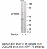 Product image for GPR176 Antibody