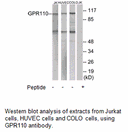 Product image for GPR110 Antibody