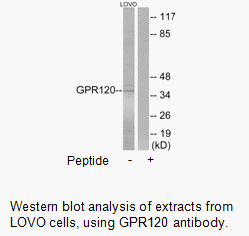 Product image for GPR120 Antibody