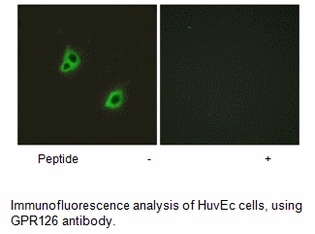 Product image for GPR126 Antibody