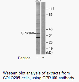 Product image for GPR160 Antibody