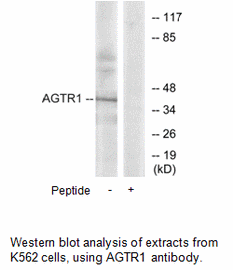 Product image for AGTR1 Antibody