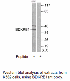 Product image for BDKRB1 Antibody