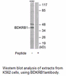 Product image for BDKRB1 Antibody