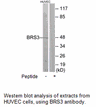 Product image for BRS3 Antibody