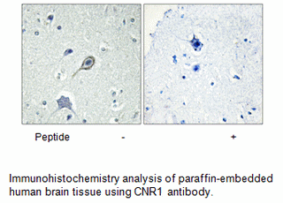 Product image for CNR1 Antibody