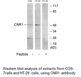 Product image for CNR1 Antibody
