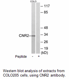 Product image for CNR2 Antibody