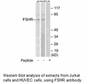 Product image for FSHR Antibody