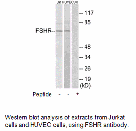 Product image for FSHR Antibody