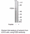 Product image for FZD5 Antibody