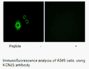 Product image for KCNJ5 Antibody