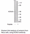 Product image for KCNJ5 Antibody