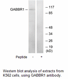 Product image for GABBR1 Antibody