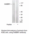 Product image for GABBR1 Antibody