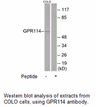 Product image for GPR114 Antibody