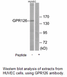 Product image for GPR126 Antibody