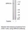 Product image for GPR133 Antibody
