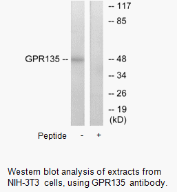 Product image for GPR135 Antibody