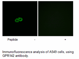 Product image for GPR142 Antibody