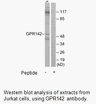 Product image for GPR142 Antibody