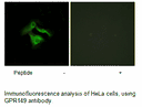 Product image for GPR149 Antibody