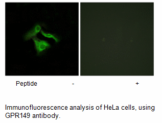 Product image for GPR149 Antibody