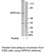 Product image for GPR153 Antibody