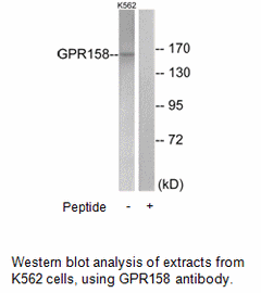 Product image for GPR158 Antibody