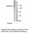 Product image for GPR158 Antibody