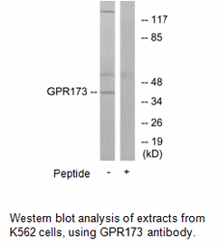 Product image for GPR173 Antibody