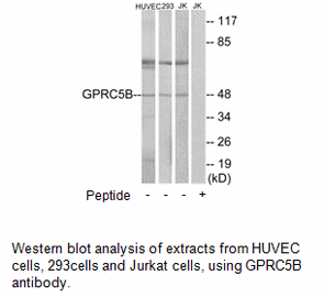 Product image for GPRC5B Antibody