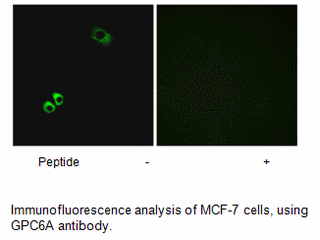 Product image for GPRC6A Antibody