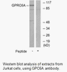 Product image for GPRC6A Antibody